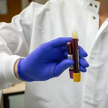 Person in lab coat wearing latex gloves holding two vials of blood.